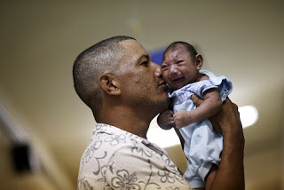  Phát hiện một bệnh nhân nhiễm virus Zika gây bệnh ‘đầu nhỏ’